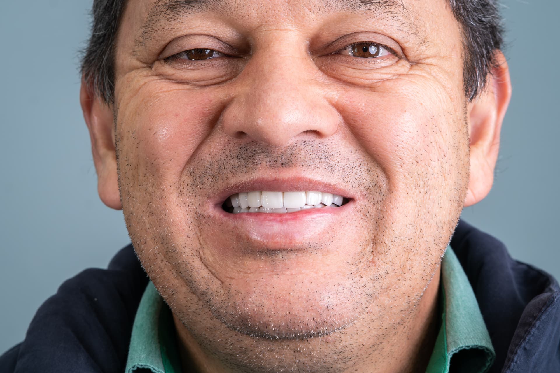 Sorriso do paciente depois do tratamento com facetas